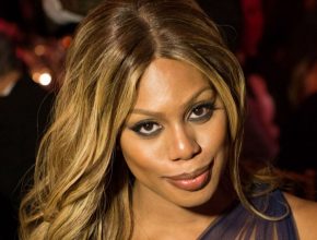 Laverne Cox plastic surgery (32)