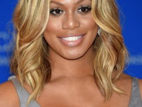 Laverne Cox plastic surgery (36)