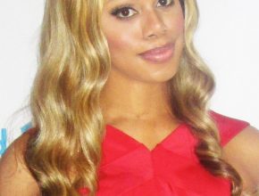 Laverne Cox plastic surgery (47)