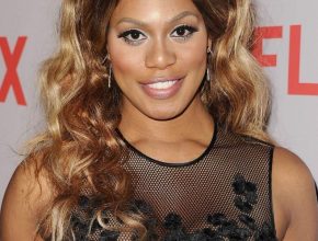 Laverne Cox plastic surgery (5)