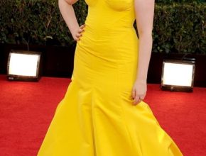 Lena Dunham plastic surgery (29)