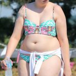 Lena Dunham plastic surgery (30)