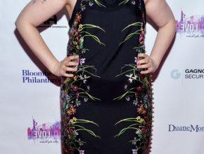 Lena Dunham plastic surgery (4)