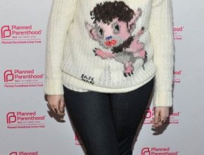 Lena Dunham plastic surgery (8)