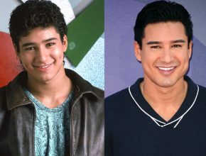 Mario Lopez before and after plastic surgery