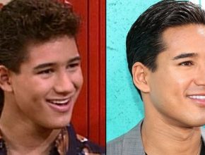 Mario Lopez before and after plastic surgery (10)