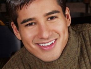 Mario Lopez plastic surgery (35)