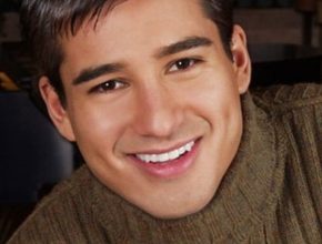 Mario Lopez plastic surgery (35)