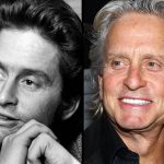 Michael Douglas before and after plastic surgery (24)