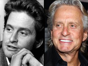 Michael Douglas before and after plastic surgery (24)