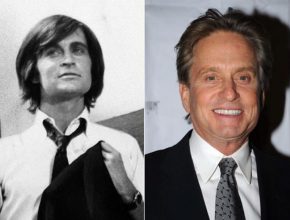Michael Douglas before and after plastic surgery