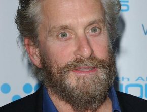 Michael Douglas plastic surgery (19)
