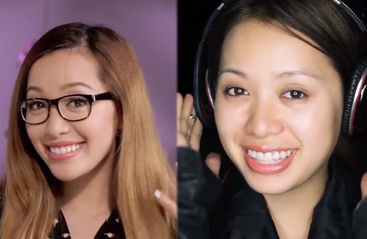 Michelle Phan before and after plastic surgery