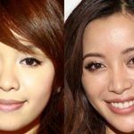 Michelle Phan before and after plastic surgery (9)