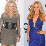 Miranda Lambert before and after plastic surgery (1)