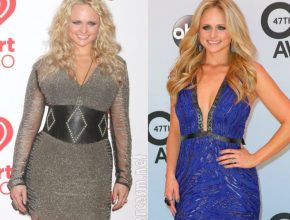Miranda Lambert before and after plastic surgery (1)