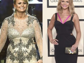 Miranda Lambert before and after plastic surgery