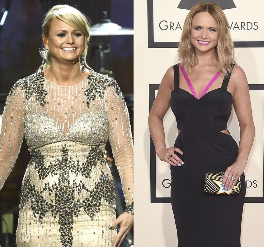 Miranda Lambert before and after plastic surgery