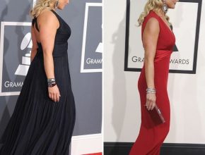 Miranda Lambert before and after plastic surgery (22)