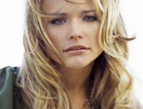 Miranda Lambert plastic surgery (35)