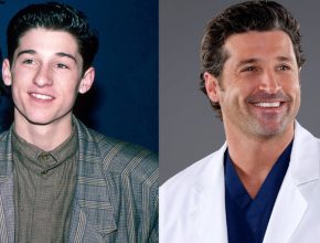 Patrick Dempsey before and after plastic surgery