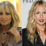 Rachel Zoe before and after plastic surgery (13)