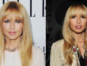 Rachel Zoe before and after plastic surgery