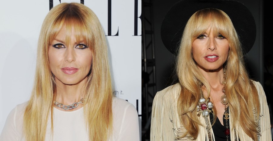 Rachel Zoe before and after plastic surgery
