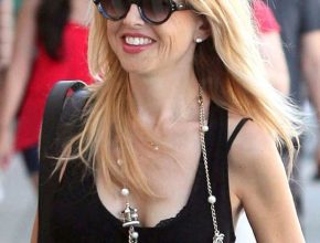 Rachel Zoe plastic surgery (14)