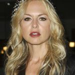 Rachel Zoe plastic surgery (17)