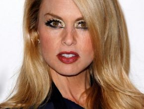 Rachel Zoe plastic surgery (19)