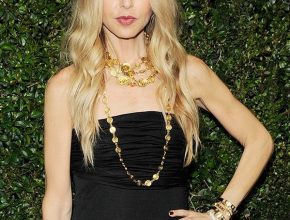 Rachel Zoe plastic surgery (24)