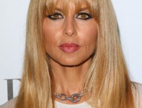 Rachel Zoe plastic surgery (25)