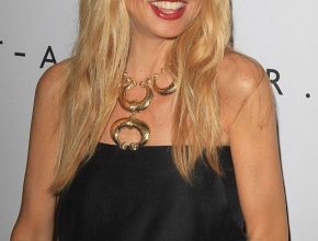 Rachel Zoe plastic surgery (34)