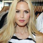 Rachel Zoe plastic surgery (35)