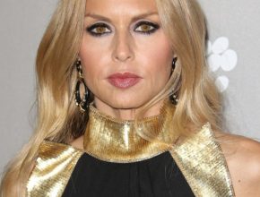 Rachel Zoe plastic surgery (7)