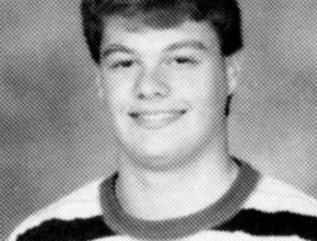 Ryan Seacrest plastic surgery (16)
