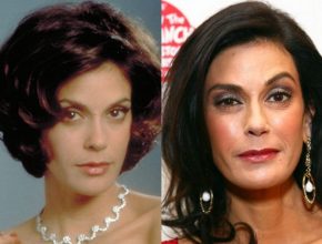 Teri Hatcher before and after plastic surgery