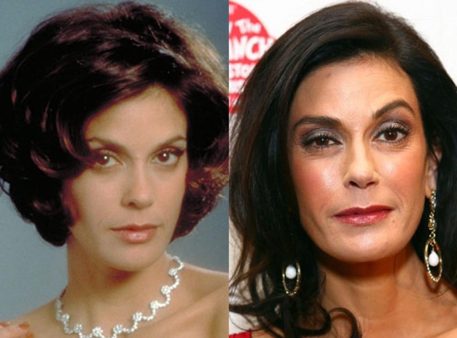 Teri Hatcher before and after plastic surgery
