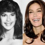 Teri Hatcher before and after plastic surgery (8)