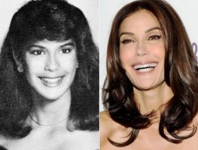 Teri Hatcher before and after plastic surgery (8)