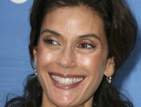 Teri Hatcher plastic surgery