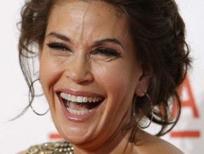 Teri Hatcher plastic surgery (36)