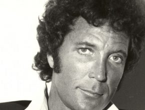 Tom Jones plastic surgery (13)