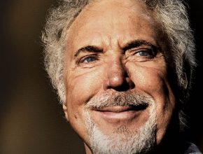 Tom Jones plastic surgery (14)