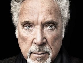 Tom Jones plastic surgery (23)