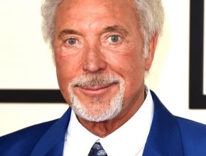 Tom Jones plastic surgery (33)