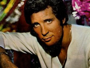 Tom Jones plastic surgery (42)