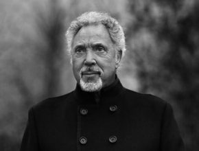 Tom Jones plastic surgery (46)