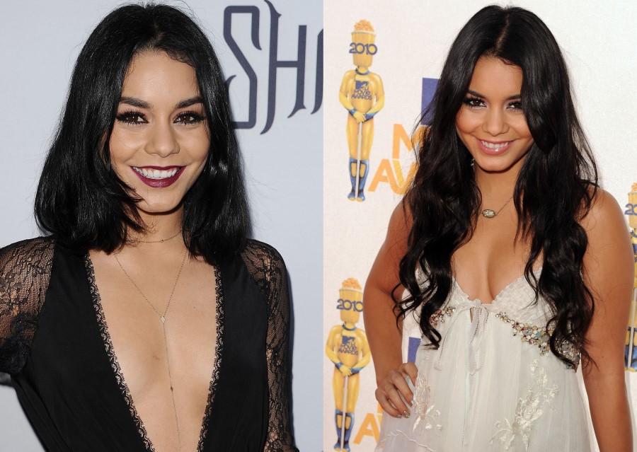 Vanessa Hudgens before and after plastic surgery